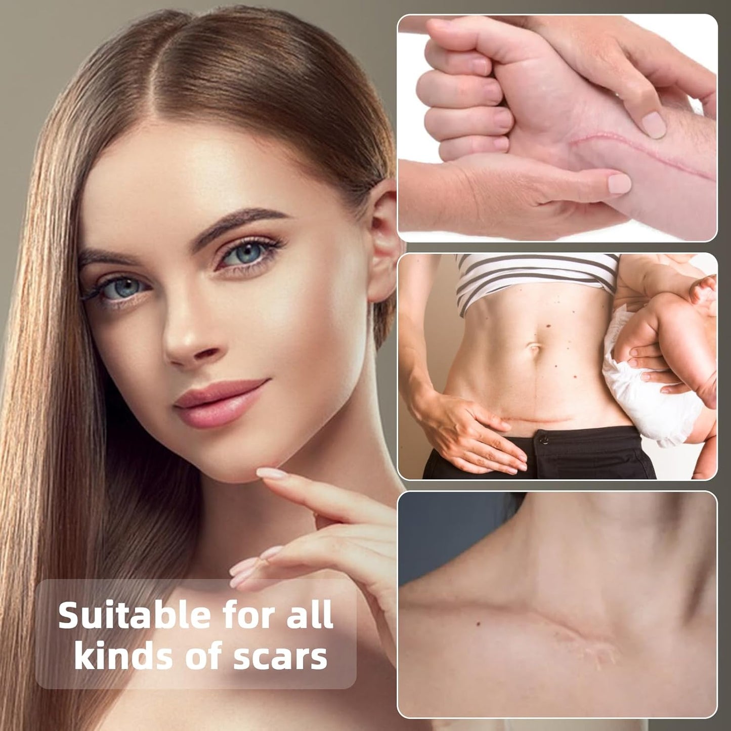 Silicone Scar Sheets