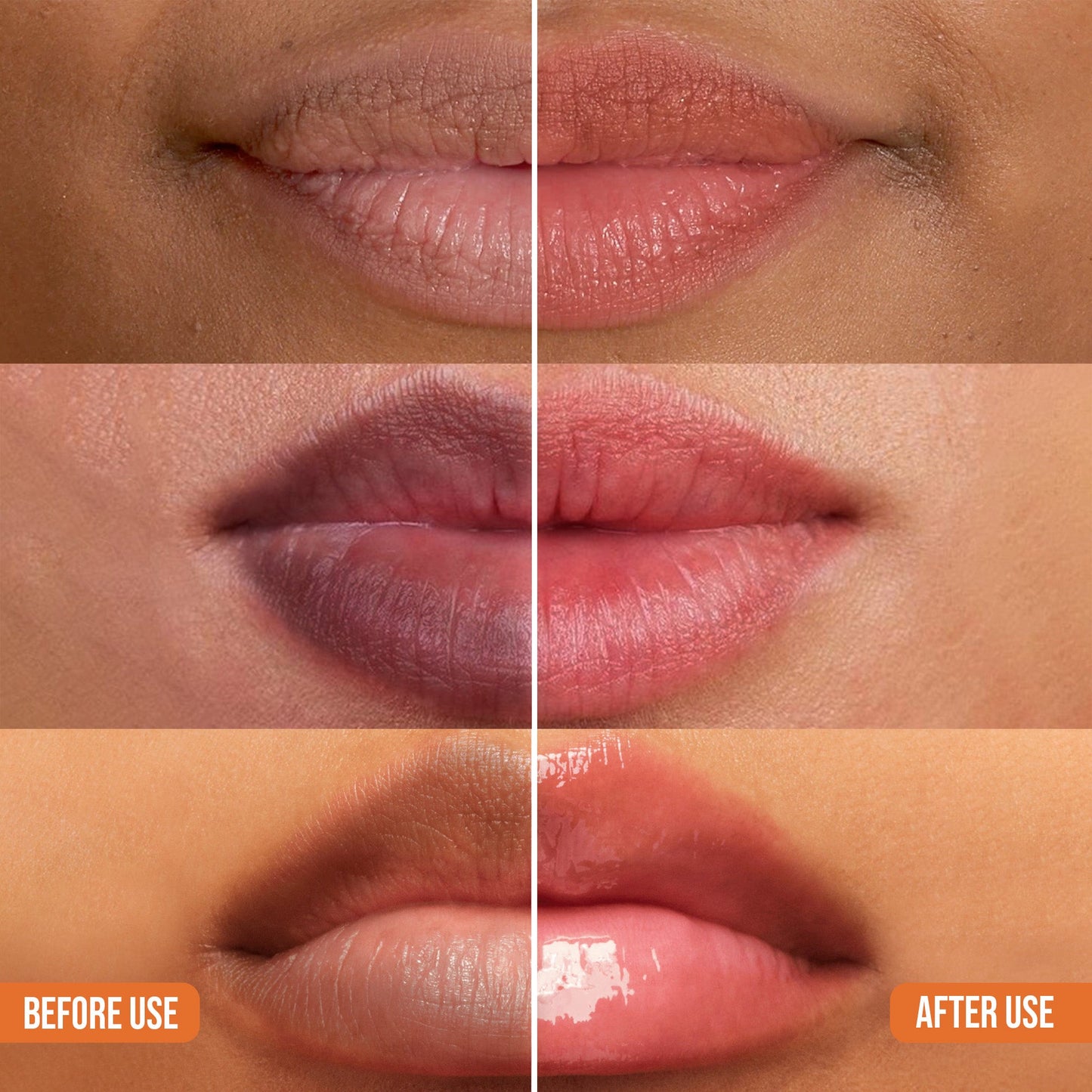 Abera Dark Lip Corrector Cream