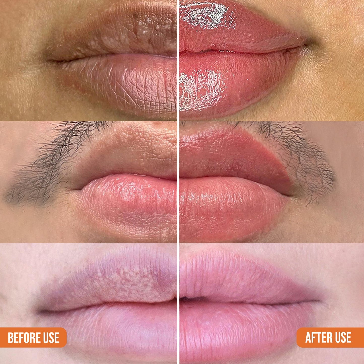 Abera Dark Lip Corrector Cream