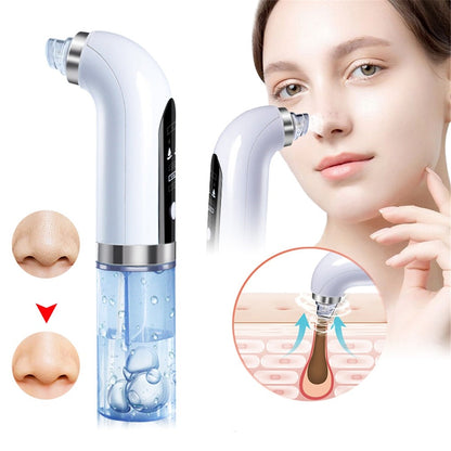 Kelvix™ Deep-Clean Pore Vacuum