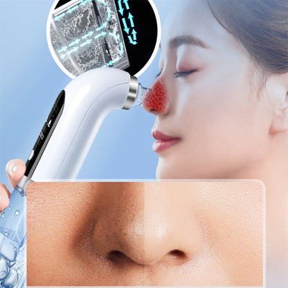 Kelvix™ Deep-Clean Pore Vacuum