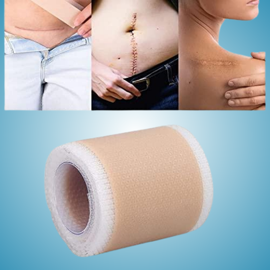 Silicone Scar Sheets