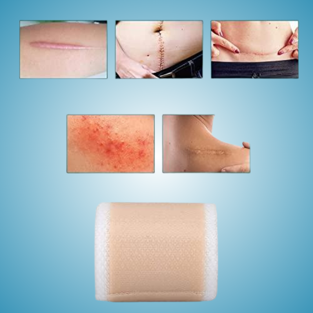 Silicone Scar Sheets
