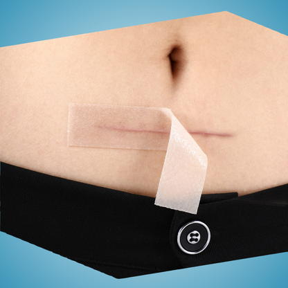 Silicone Scar Sheets