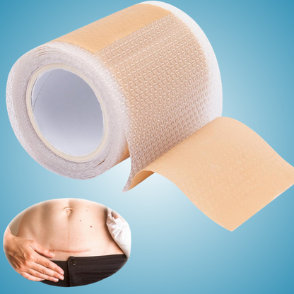 Silicone Scar Sheets